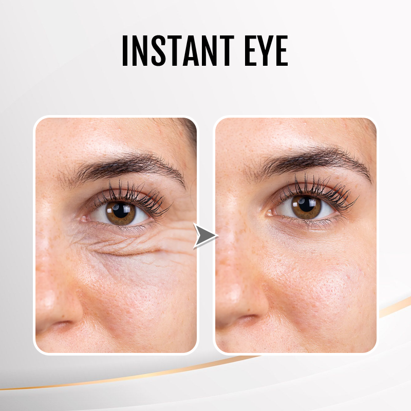 🔥 Last Day Discount: 50% OFF💐Instant Wrinkle Eye Tightener cream