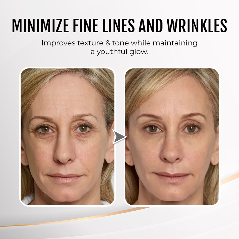 🔥 Last Day Discount: 50% OFF💐Instant Wrinkle Eye Tightener cream